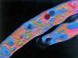 Бактерии туберкулеза.